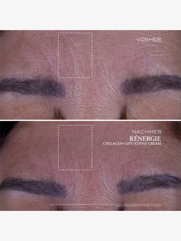 Rénergie Collagen+ Lift-Xtend Creme, LANCÔME